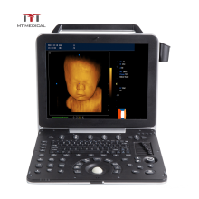 Medical Ultrasound Instruments Cardiac Echo 4D Portable Color Doppler Ultrasound machine